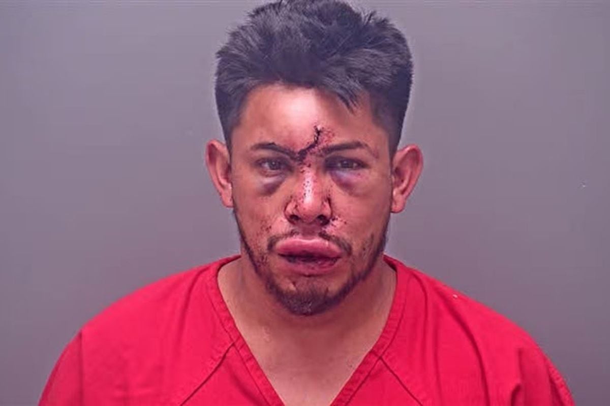 13 yaşındaki çocuk, babasını bu hale getirdi