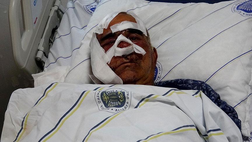 Kentte 5'inci ayı dehşeti! Hayvan otlatırken saldırdı: 'Yüzünde çok büyük kesiler, yırtıklar vardı'