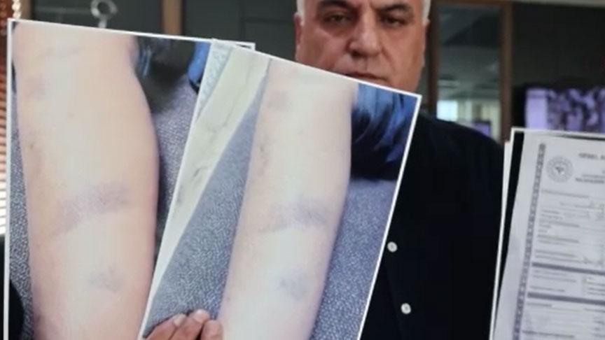 Özel okulda darp iddiası! 8 yaşındaki çocuğun ailesi ve okul yönetimi karşı karşıya