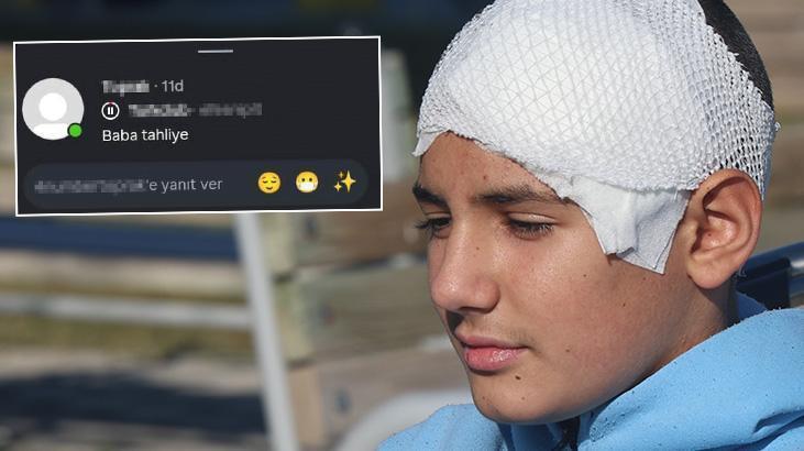 Okulda kan donduran zorbalık! Arkadaşının kafatasını parçaladı, 'baba tahliye' paylaşımı yaptı