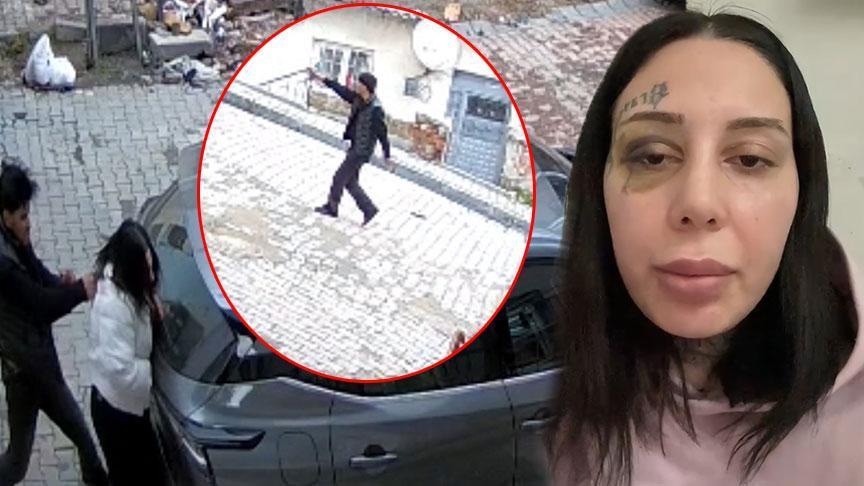 Sokak ortasında eşinin başına silah dayayıp darbetti! Şok savunma: Estetik yaptırıp benden boşanmak istedi