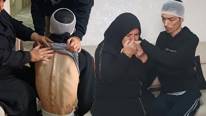 Bakımevinde engelliye darp skandalı! 'Oğlumu görünce içim parçalandı'