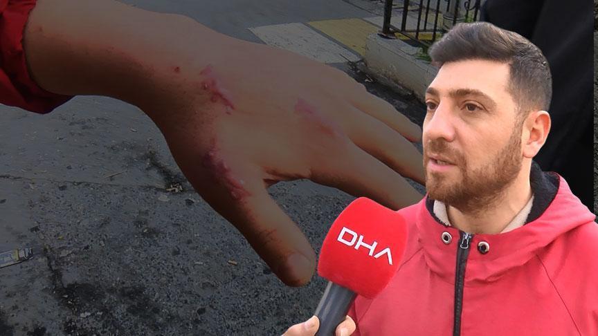 Evindeki Kedisi elini ısırdı, 13 gün sonra kabusu yaşadı: Dünya tıp literatüründe bir ilk