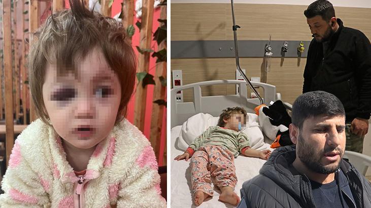 Yalova’da 14 aylık bebeği hastanelik ettiler! İddiaların odağındaki komşu konuştu