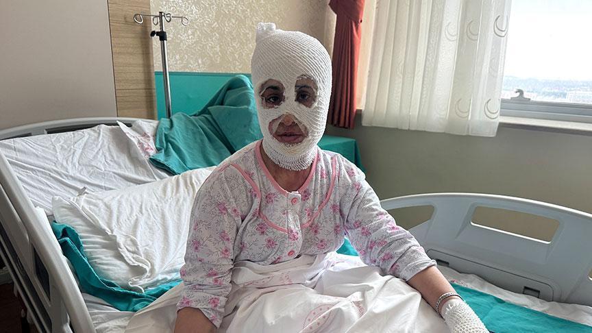 İftar vakti düdüklü tencere faciası! ‘Yüzüme elimi sürdüm, et parçası geliyordu'