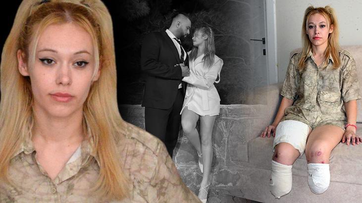 En mutlu gününde iki bacağını kaybetti! İsyan ettiren son