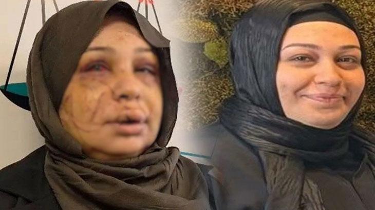 Eşinin yüzünü 60 dikiş atıldı! Kendini böyle savundu: Ben büyük bir aile katliamını önledim