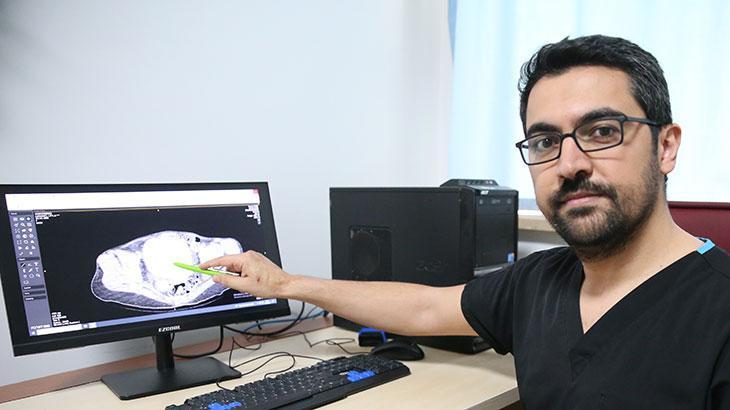 Doktorlar bile bunu beklemiyordu! Ameliyatı aldılar: Görünce şok olduk