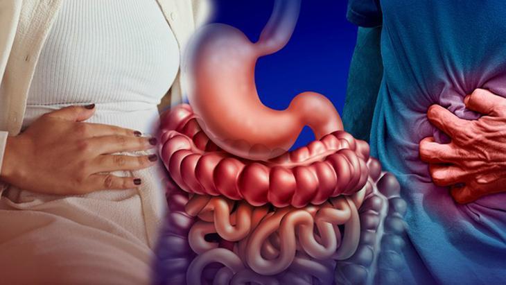 Huzursuz bağırsak mı, kanser belirtisi mi? ‘Alarm belirtileri var: Ciddiye alınmalı’