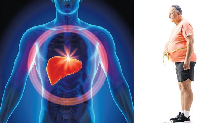 Küresel salgın: Karaciğer yağlanması