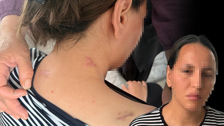 Ölü numarası yaparak kurtuldu: Geceleri uyuyamıyorum