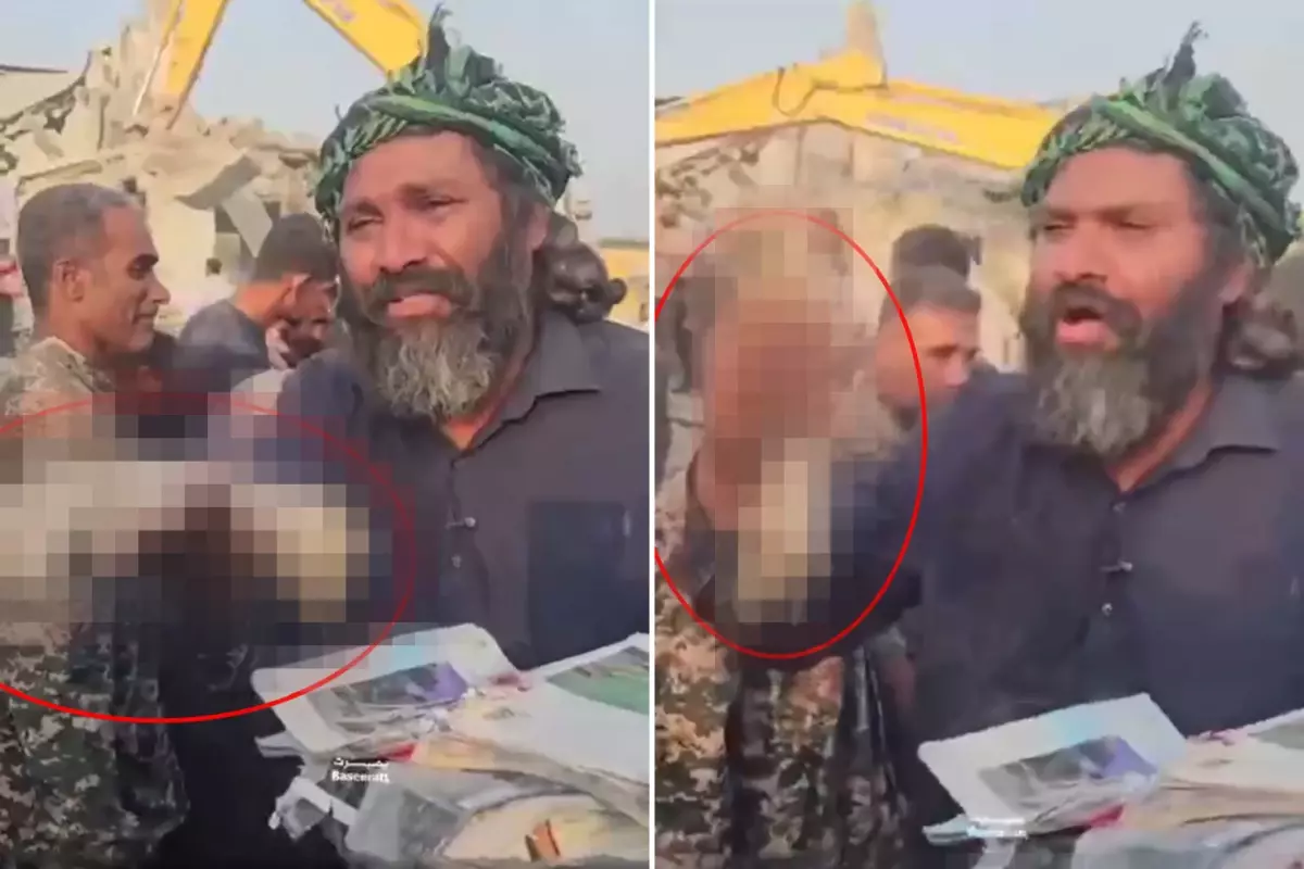 İran'da İlkokulda öldürülen kız çocuğunun kopan elini gösterip isyan etti: Dünya bu cinayeti görmeli