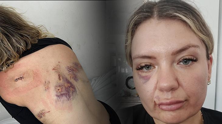 ‘Bugün büyük gün’ diyerek aradı! Dehşeti anlattı: Şanslıydım ki bıçak sırtımda kırıldı