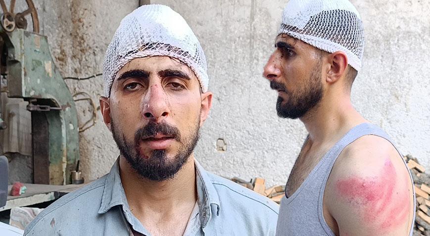 50 kilometre hız dayağı! Burnu kırıldı, başına 8 dikiş atıldı