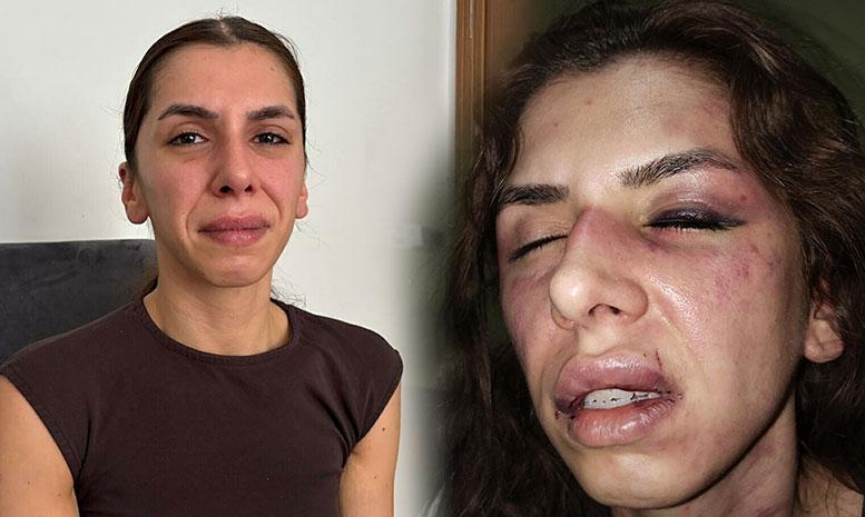 Eşi tarafından 4 saat işkence gördü, boğazına bıçak dayandı: Öldüm sandım ama bayılmışım